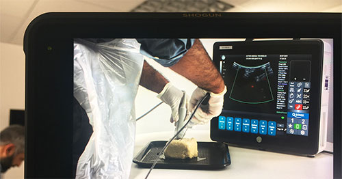 Ultrasonic needles for more efficient medical procedures and drug delivery medical procedureon a computer screen